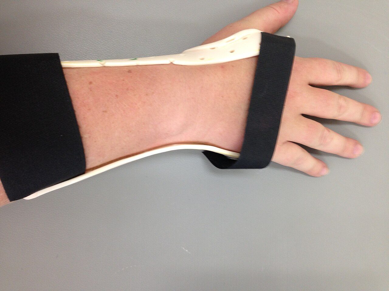 Hand, Handgelenk, Ellenbogen